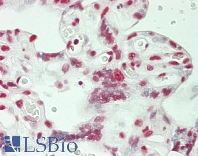 IHC-plus™ HnRNP U Antibody (aa450-500)