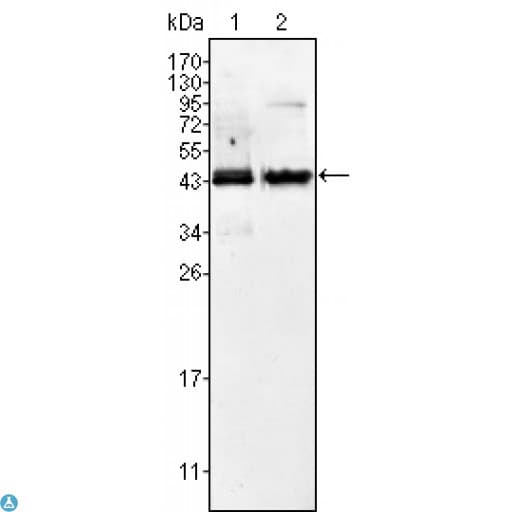 AMACR / P504S Antibody
