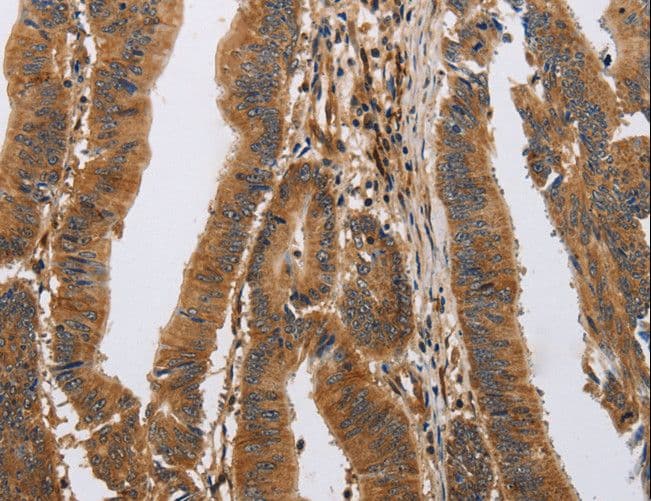 Polyclonal Rabbit anti-Human ITPR1 / IP3 Receptor Type 1 Antibody (IHC)