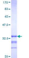 Human MC3R / MC3 Receptor Protein (Recombinant GST, N-terminus)