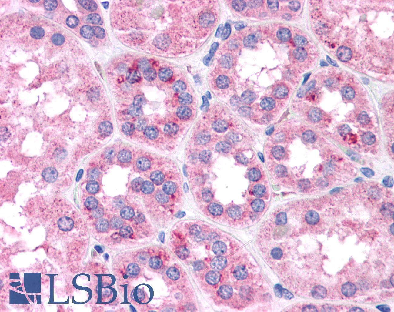 IHC-plus™ Kinesin Heavy Chain / KIF5B Antibody (clone KN-03)