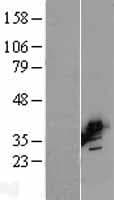 BCAT2 Protein (Over-Expression Lysate Myc-DDK (Flag))