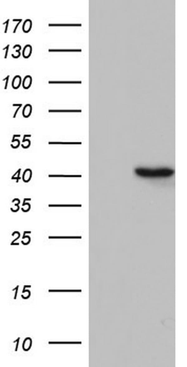 TFB1M Antibody (aa116-346, clone OTI6G4)