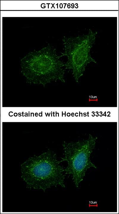 Polyclonal Rabbit anti-Human SH3BP1 Antibody (aa639-701, IHC, WB)