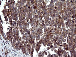 IHC-plus™ TUBB1 / Tubulin Beta 1 Antibody (clone 4A3)