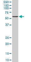 IHC-plus™ CACNB2 Antibody (clone 6C1)