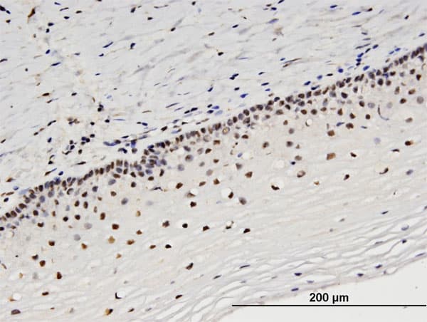 STRADA / LYK5 Antibody (clone 4E4)