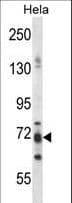PJA1 / PRAJA1 Antibody (aa155-183)