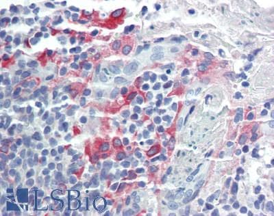 IHC-plus™ DHRS9 Antibody