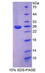 Human ITIH3 Protein (Recombinant His-T7)