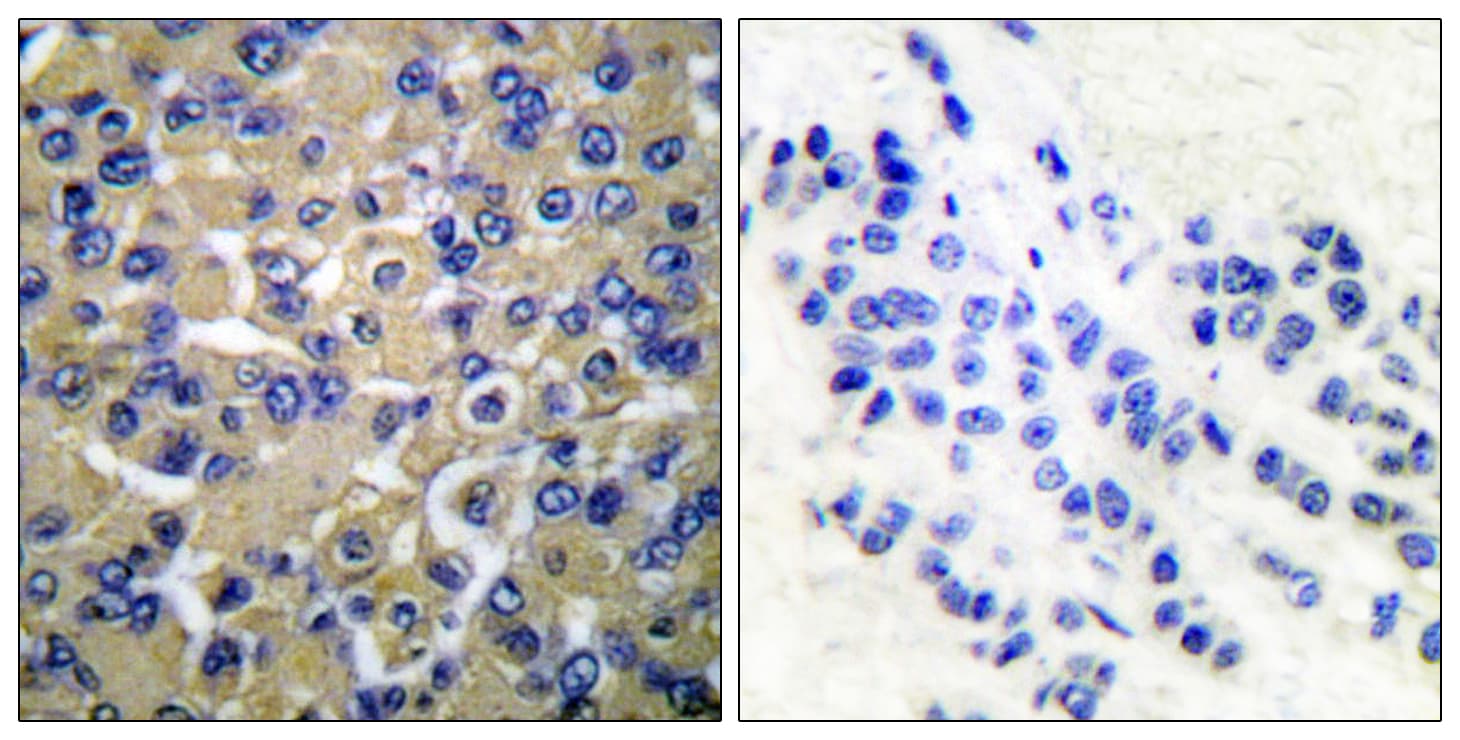 Polyclonal Rabbit anti-Human WNK1 Antibody (aa24-73, IHC, WB)