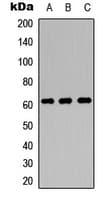 Polyclonal Rabbit anti-Human SLC22A4 / OCTN1 Antibody (Internal, WB)