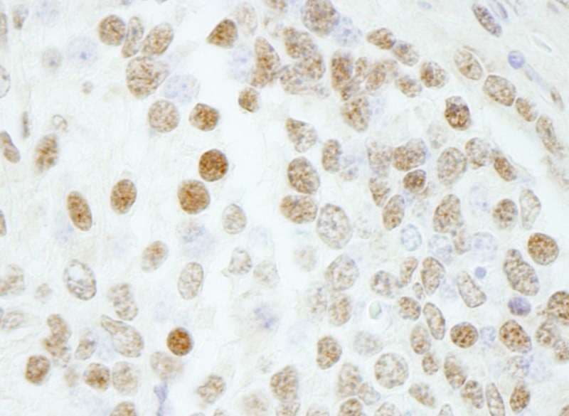 BAF53 / ACTL6A Antibody (aa25-75)