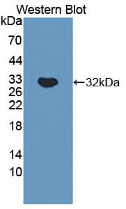 TNXB / Tenascin XB Antibody (aa3824-4071)