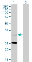 Monoclonal Mouse anti-Human STAR Antibody (clone 5F9, WB)