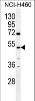 CPA6 / Carboxypeptidase A6 Antibody (aa285-315)