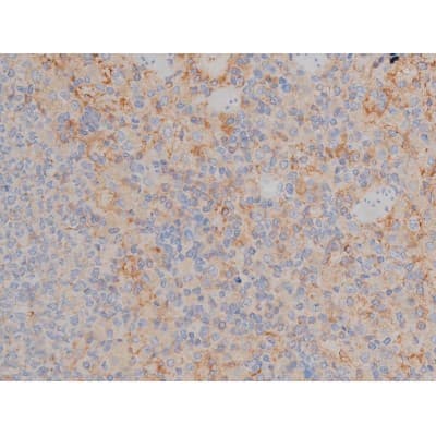 SYN / FYN Antibody (phospho-Tyr530)