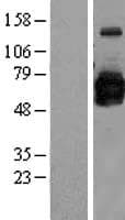 GOLM1 / GP73 / GOLPH2 Protein (Over-Expression Lysate Myc-DDK (Flag))