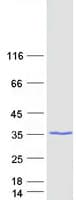 Human HDHD3 Protein (Recombinant Myc-DDK (Flag))