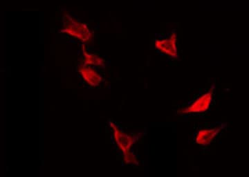 PTP1B Antibody (phospho-Ser50)