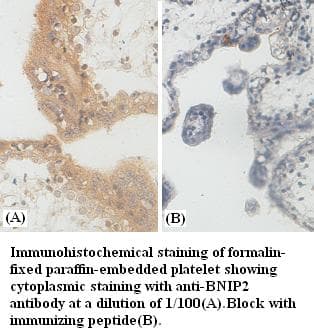 BNIP2 Antibody