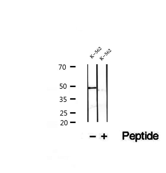Polyclonal Rabbit anti-Human FECH / Ferrochelatase Antibody (IHC, IF, WB)