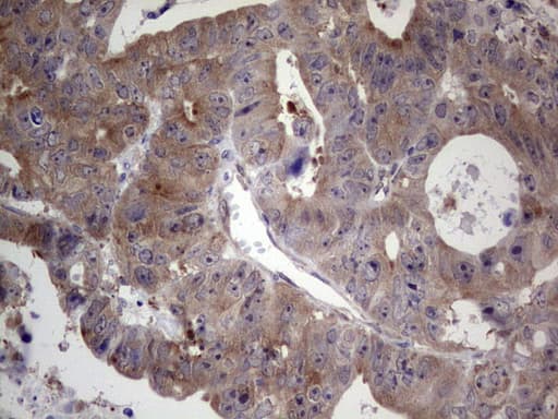 DICER1 / Dicer Antibody (aa1666-1922, clone OTI2B1)