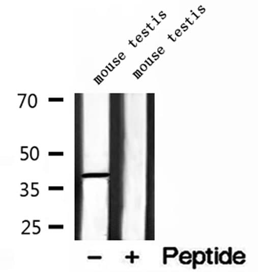 Polyclonal Rabbit anti-Human MTHFD2 Antibody (IHC, IF, WB)