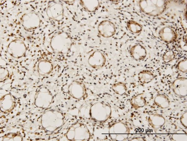 Monoclonal Mouse anti-Human HEYL Antibody (clone 1F6, IHC, IF, WB)