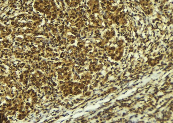 Polyclonal Rabbit anti-Human ATR Antibody (phospho-Ser428, IHC, WB)