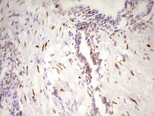 MEF2D Antibody (aa1-282, clone OTI1E11, Carrier-free)