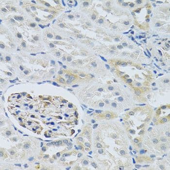 SLC29A1 / ENT1 Antibody