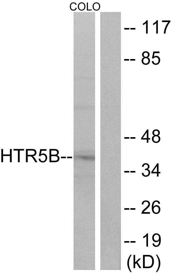 Polyclonal Rabbit anti-Mouse Htr5b Antibody (IF, WB)
