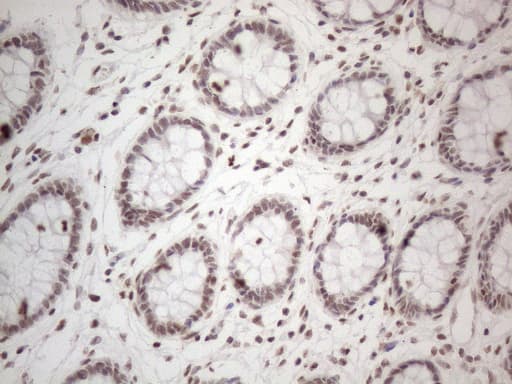NR2C2 / TAK1 Antibody (aa1-241, clone OTI4B1)