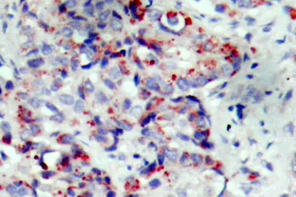 MAP2K4 / MKK4 Antibody (phospho-Ser80)