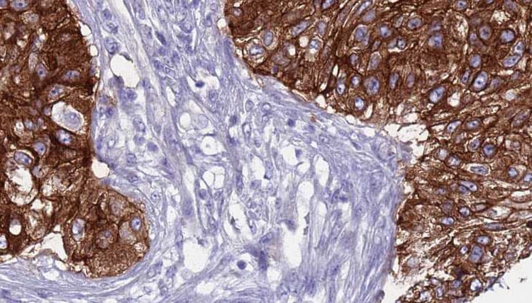 Polyclonal Rabbit anti-Human SMPD2 Antibody (IHC, IF, WB)