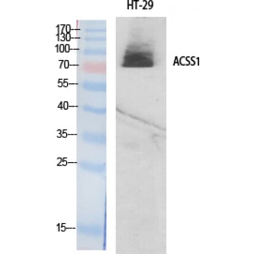 Polyclonal Rabbit anti-Human ACSS1 Antibody (580-660 aa, C-terminal, IHC, WB)