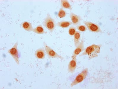 HIST1H2BN Antibody