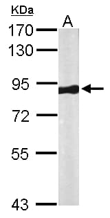 Polyclonal Rabbit anti-Human VPS35 Antibody (aa733-796, IHC, WB)