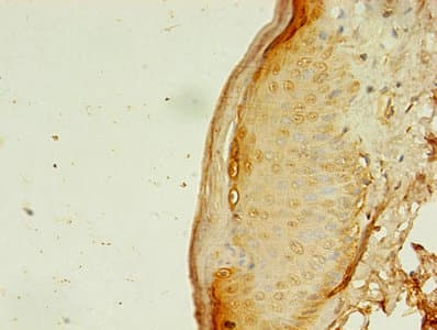 Polyclonal Rabbit anti-Human APAF1 / APAF-1 Antibody (IHC)
