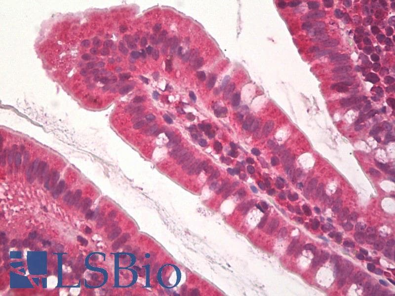 IHC-plus™ Polyclonal Goat anti-Human JHDM1A / KDM2A Antibody (aa139-153, IHC, WB)