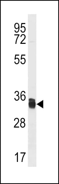 TXNDC1 / TMX1 Antibody (aa239-267)
