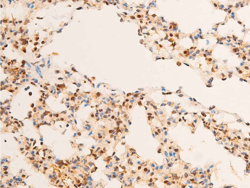 JUN / c-Jun Antibody (phospho-Thr93)