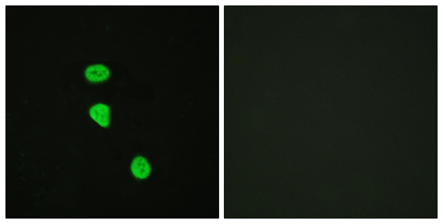 TBC1D4 / AS160 Antibody (phospho-Thr642)