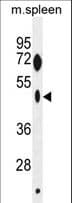 ZNF385C Antibody (aa77-106)