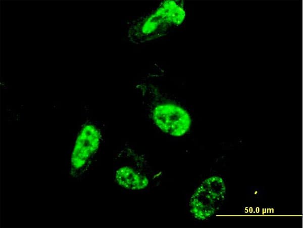 Monoclonal Mouse anti-Human PML Antibody (clone 1D12, IF, WB)
