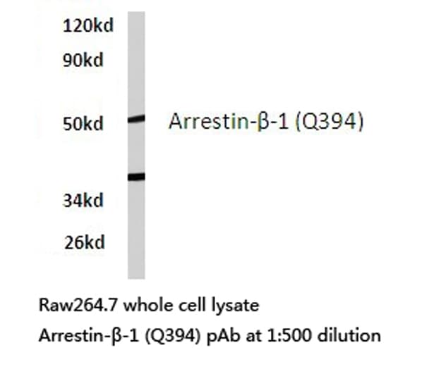 Polyclonal Rabbit anti-Human ARRB1 / Beta Arrestin 1 Antibody (Gln394, IHC, IF, WB)