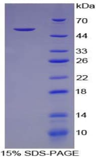 Mouse AMBP Protein (Recombinant His-GST)