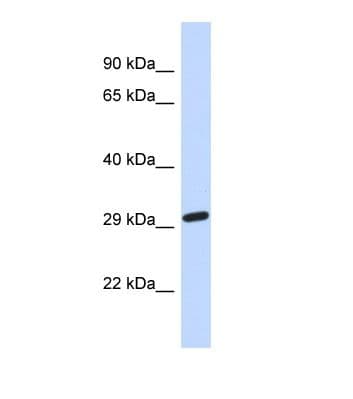 Polyclonal Rabbit anti-Human NAALAD2 Antibody (aa102-151, WB)