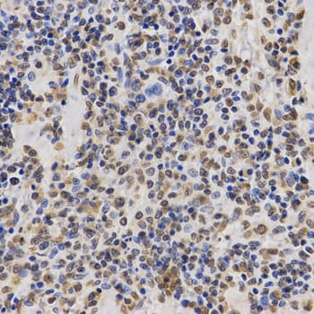 Polyclonal Rabbit anti-Human Histone H3 Antibody (Tri-Methyl-Lys36, IHC, IF, WB)
